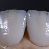 STAINED AND GLAZED E.MAX