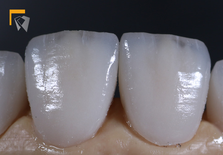 STAINED AND GLAZED E.MAX
